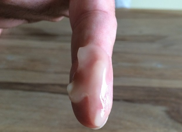 Bild 3: Vor der Anwendung einen Gelstreifen OralClean+Care 3-in-1 Gel von PLATINUM Natural Pet Food &Care auf den Finger auftragen